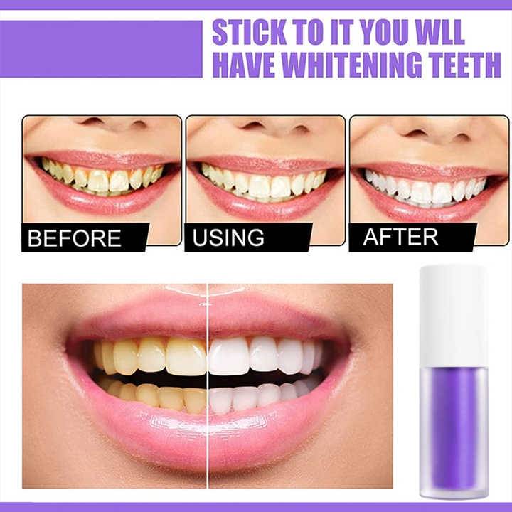 Smilekit Teeth Whitening Toothpaste